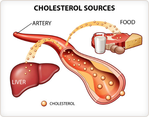 Cholesterol Lowering Foods